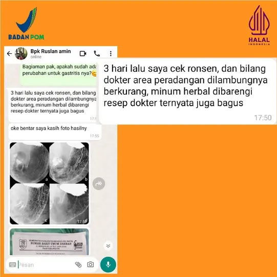 rontgen-50-ezgif.com-resize